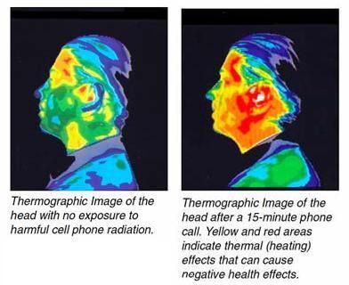 Blocks up to 99% of radiation from entering the ear.