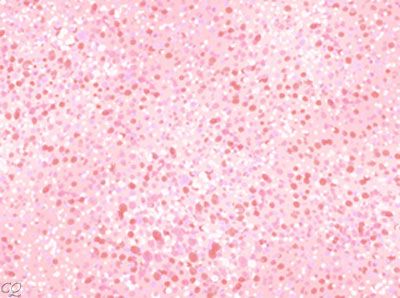 Loralie Breast Cancer Fabric Still Confetti Light Pink  