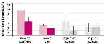 3M ESPE RelyX Luting 2 Cement, DENTAL SUPPLY, Universal  